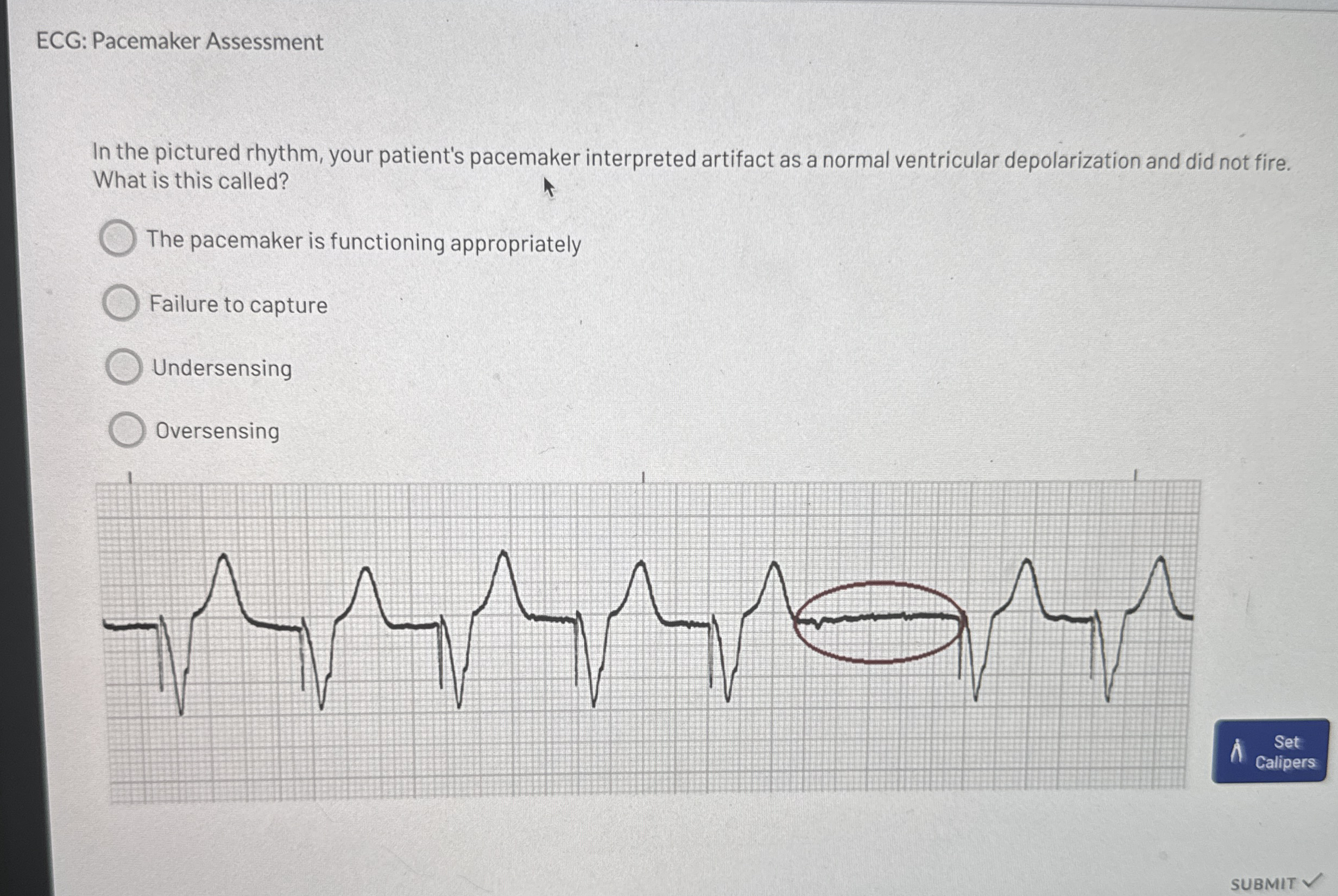 Solved ECG: Pacemaker AssessmentIn the pictured rhythm, | Chegg.com