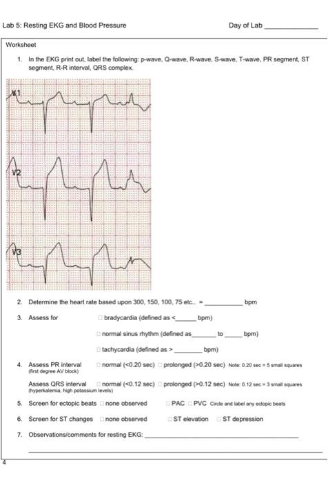 Solved Lab 5 Resting Ekg And Blood Pressure Day Of Lab Chegg Com