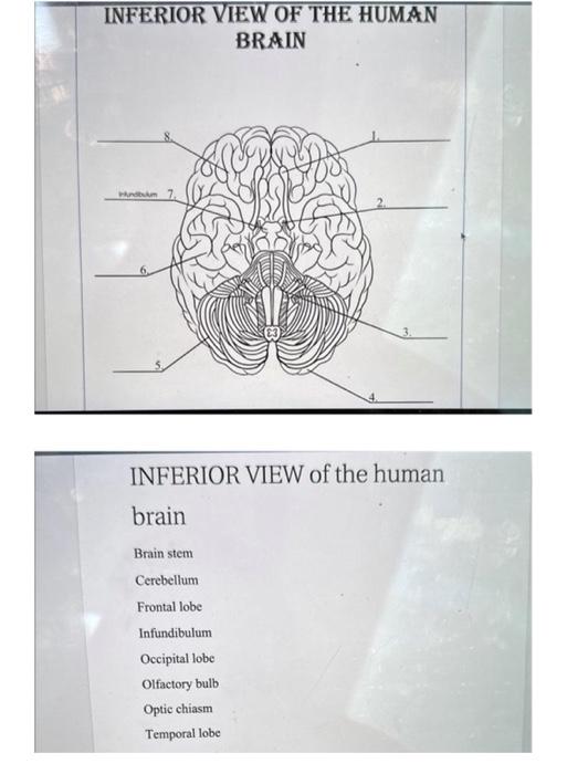 infundibulum brain