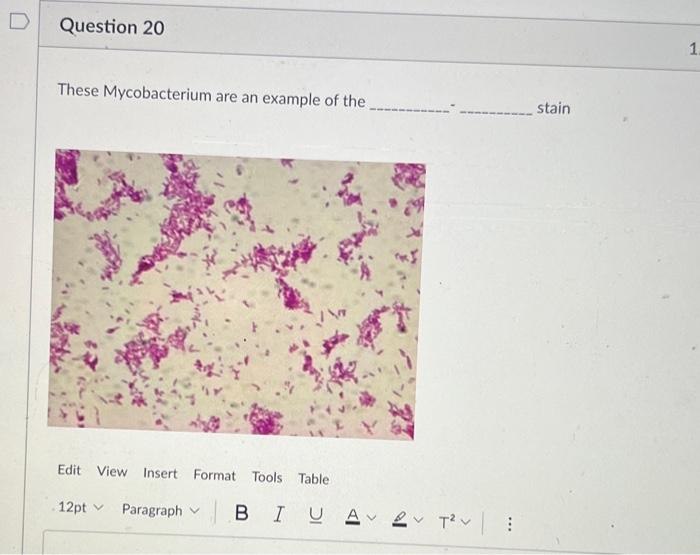 Solved Microbiology I WILL GIVE YOU THUMBS UP If You Answer | Chegg.com