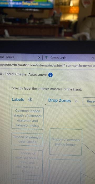 Correctly label the intrinsic muscles of the hand. | Chegg.com