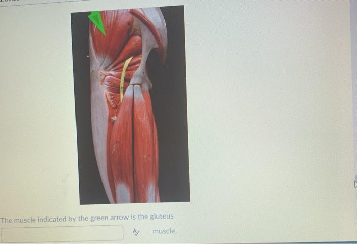 The muscle indicated by the green arrow is the gluteus A/ muscle.