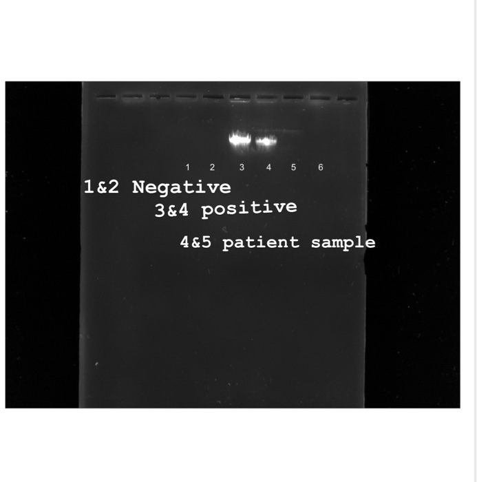 5 3 4 plus negative 1 4