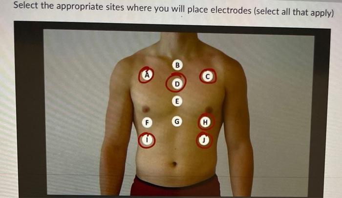 Zynex Medical on X: Our Electrode Placement Guide video has a ton of  easy-to-use, visual examples of how and where to place your electrodes when  treating with your Zynex NexWave device. Check