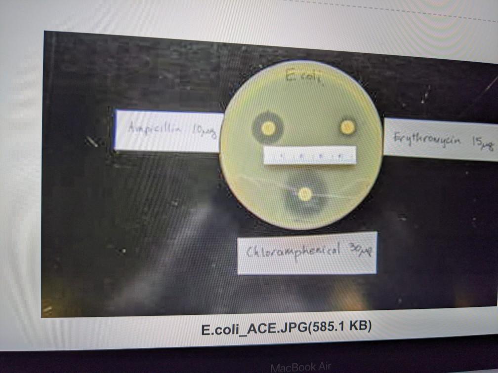 Disk Diffusion Results Diameter of Zone of Inhibition | Chegg.com