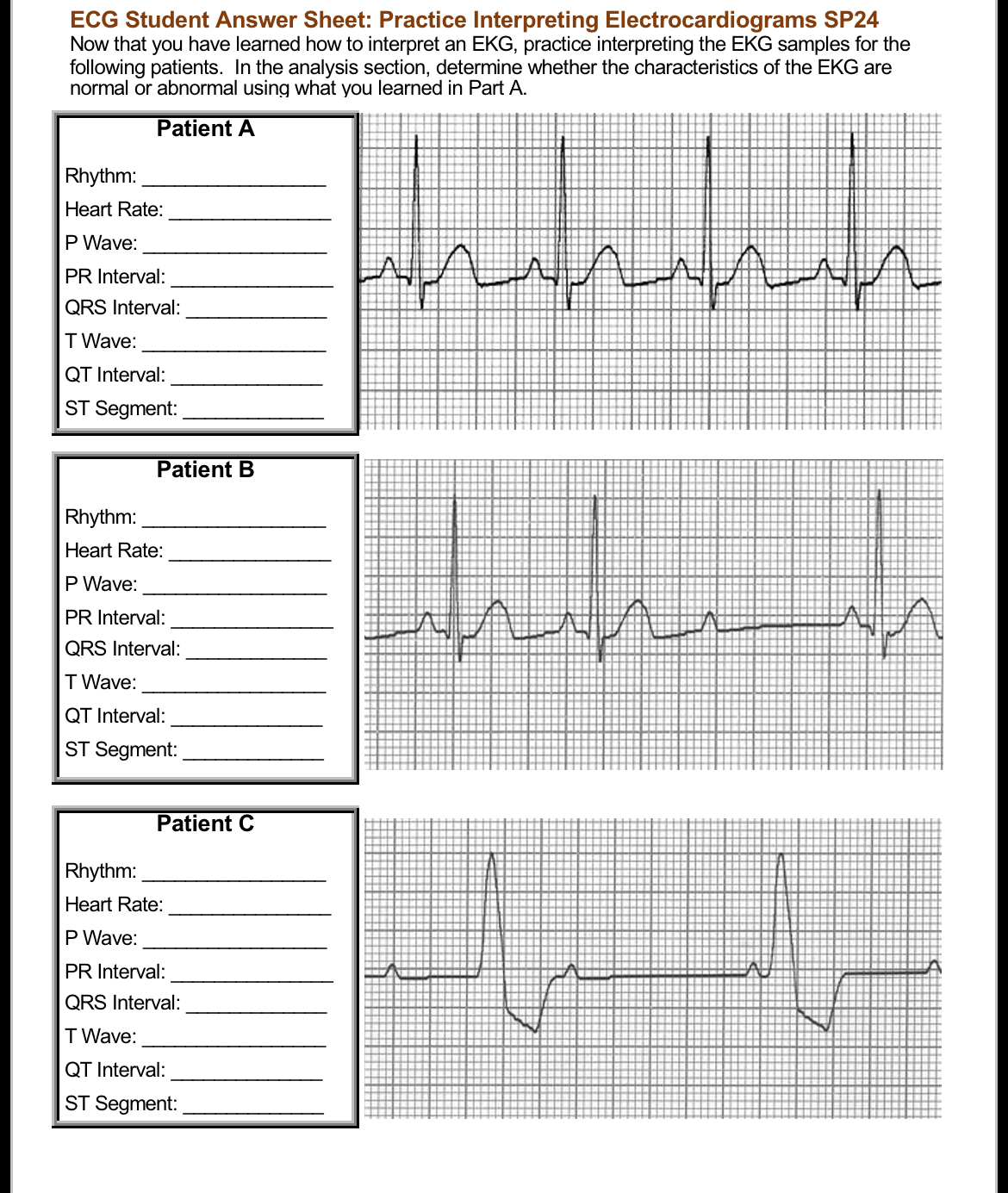 Solved ECG Student Answer Sheet: Practice Interpreting | Chegg.com