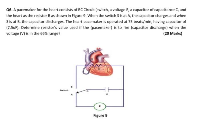 Solved Figure 6Q6. A pacemaker for the heart consists of RC | Chegg.com
