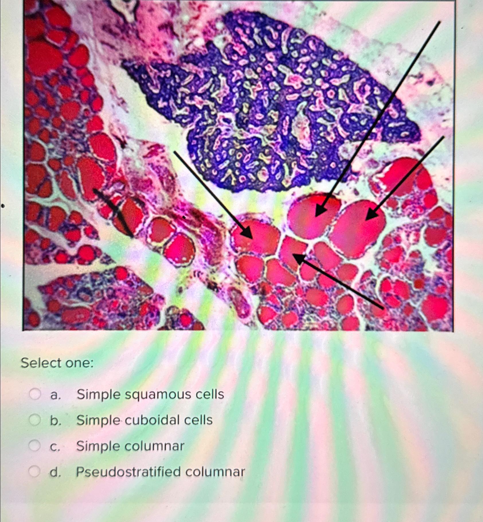 Solved Select onea. ﻿Simple squamous cellsb. ﻿Simple