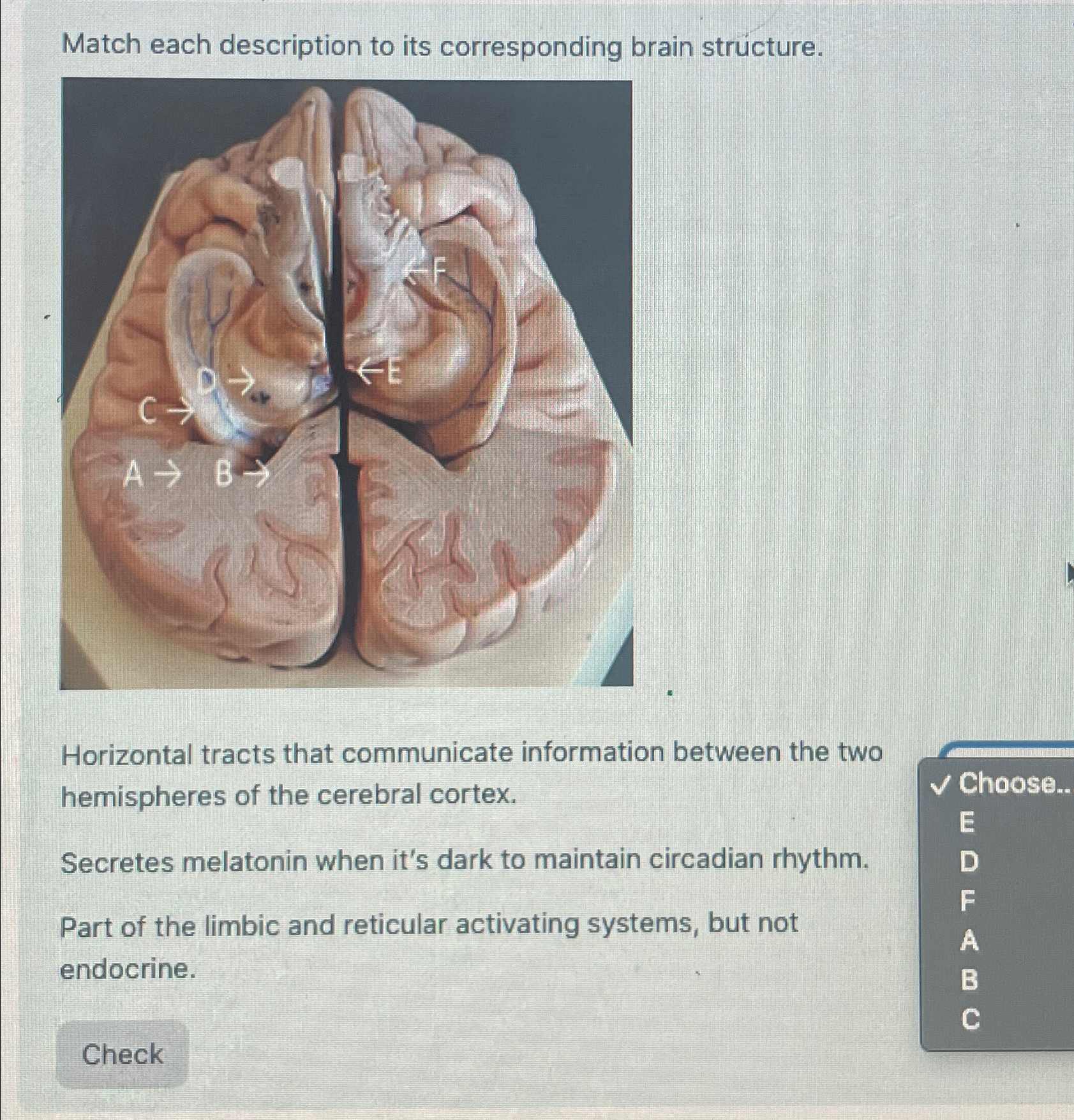 Solved Match each description to its corresponding brain | Chegg.com