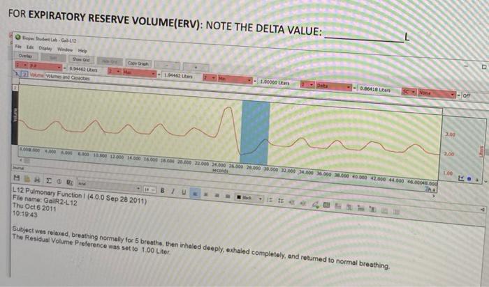 FOR EXPIRATORY RESERVE VOLUME(ERV): NOTE THE DELTA VALUE: b. 0.94462 100000 0.48 SC - On 3.00 6.000 15000 1.000 1.000 1.000 1