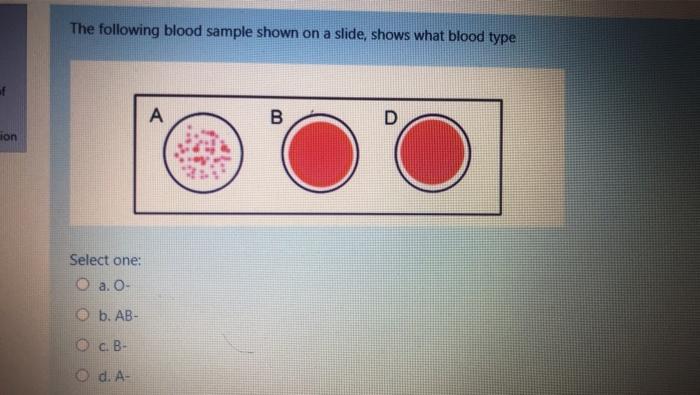 Solved The Following Blood Sample Shown On A Slide, Shows | Chegg.com