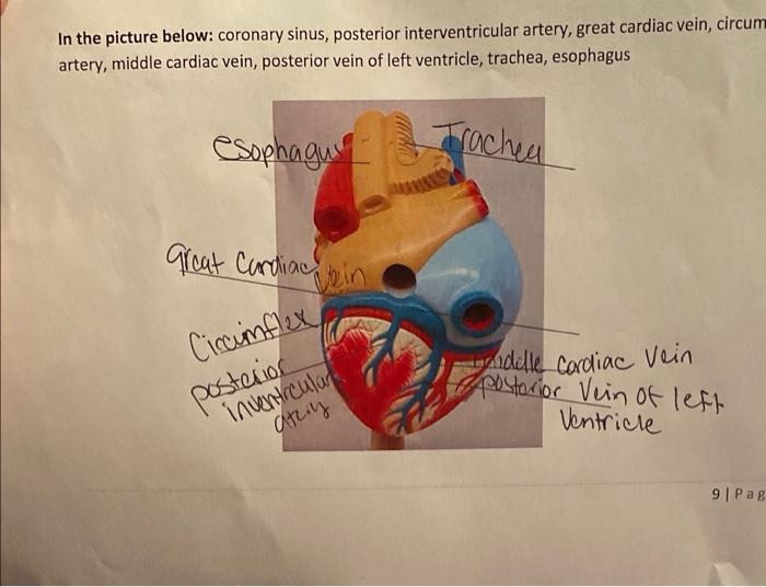 In the picture below: coronary sinus, posterior interventricular artery, great cardiac vein, circum artery, middle cardiac ve