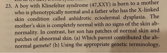 Solved Why A Freemartin Develops 13 An Attached X Female Chegg Com