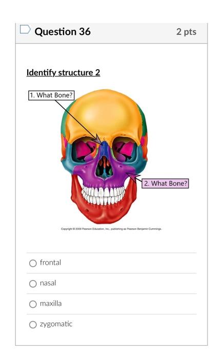 Question 36
frontal
nasal
maxilla
zygomatic