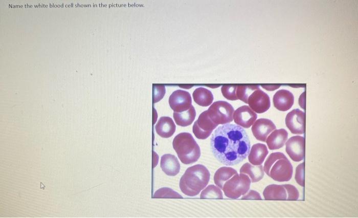 Solved Name the white blood cell shown in the picture below. | Chegg.com