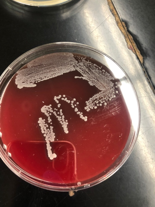 Solved Nutient Agar and Blood Agardescribe(morphology, color | Chegg.com