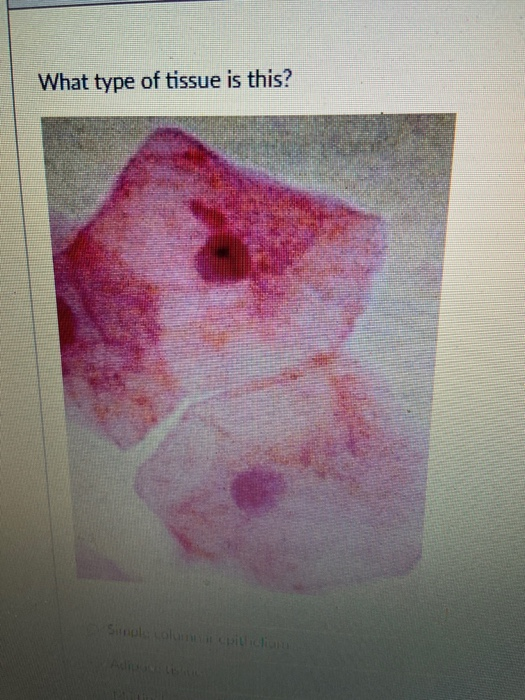 Solved What Type Of Tissue Is This? | Chegg.com