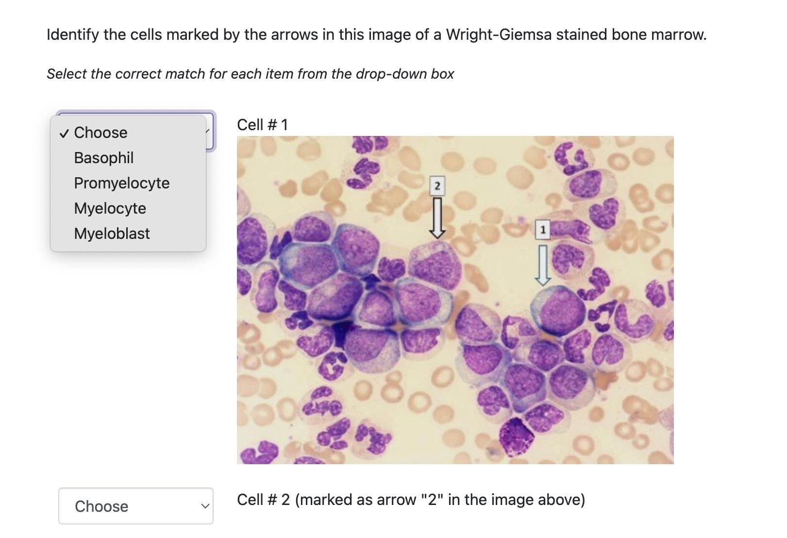 Marrow - #mcqwithmarrow #imagebased #RecentAIMS The brace shown in