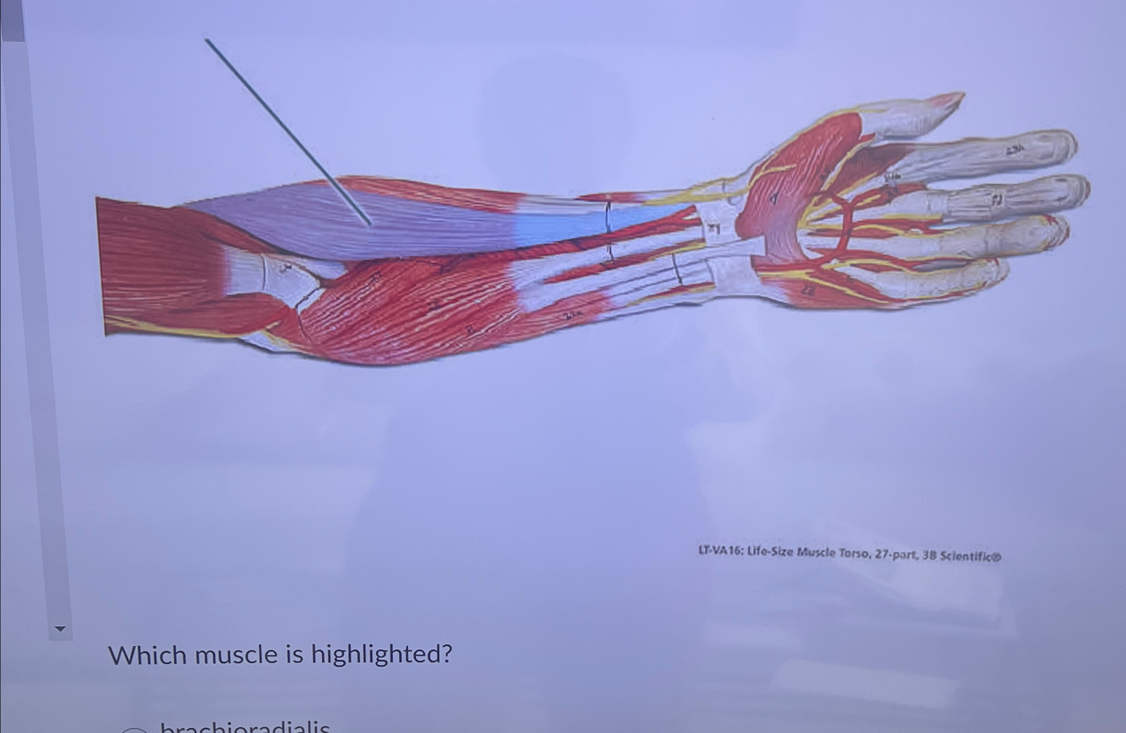 Solved Lr-Va16: Life-Size Muscle Torso, 27.port, 38 | Chegg.com