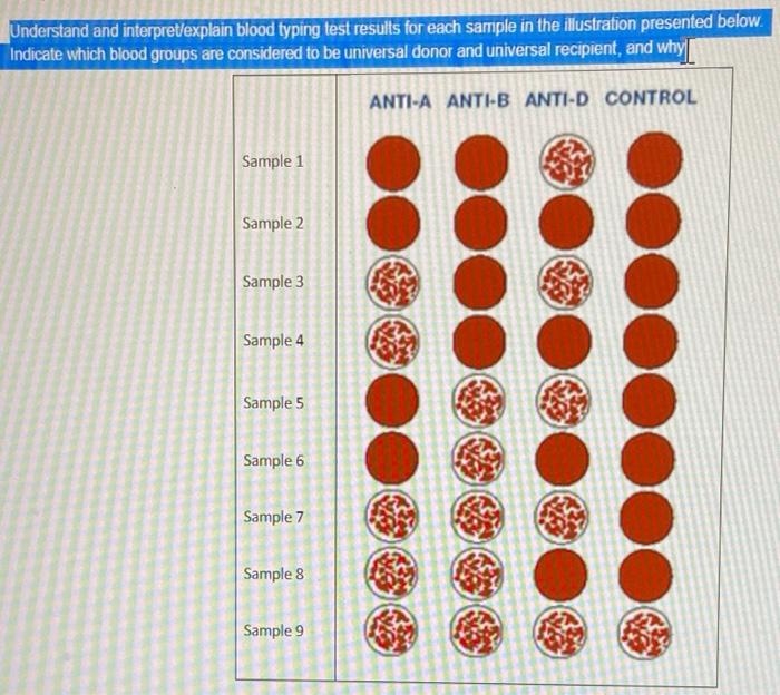 Understanding Blood Type Results