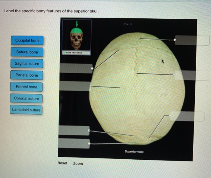 Bony Features Of The Superior Skull