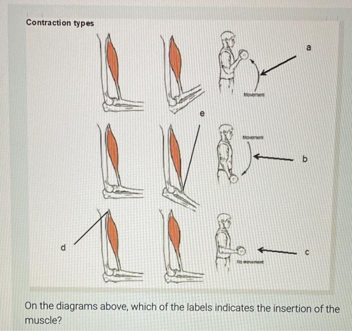 Solved Contraction types a a LV- 1 ( c E b d Namovement On | Chegg.com