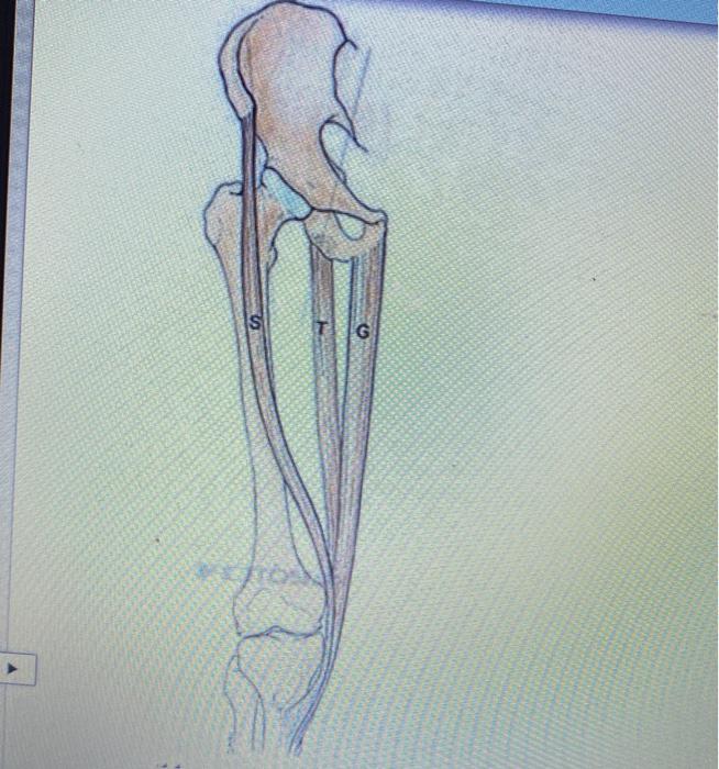 Solved TG The Tripod Muscles of the Thigh all insert on