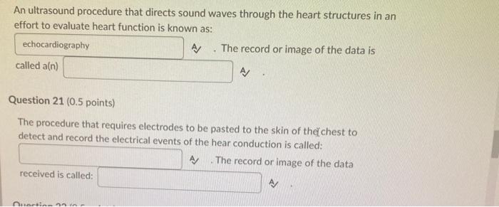 An ultrasound procedure that directs sound waves through the heart structures in an effort to evaluate heart function is know