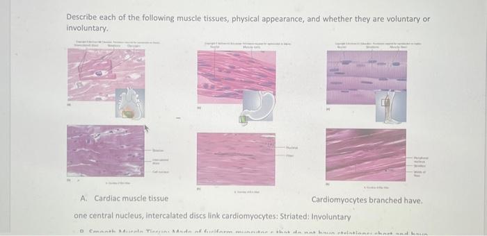 Solved Describe each of the following muscle tissues, | Chegg.com