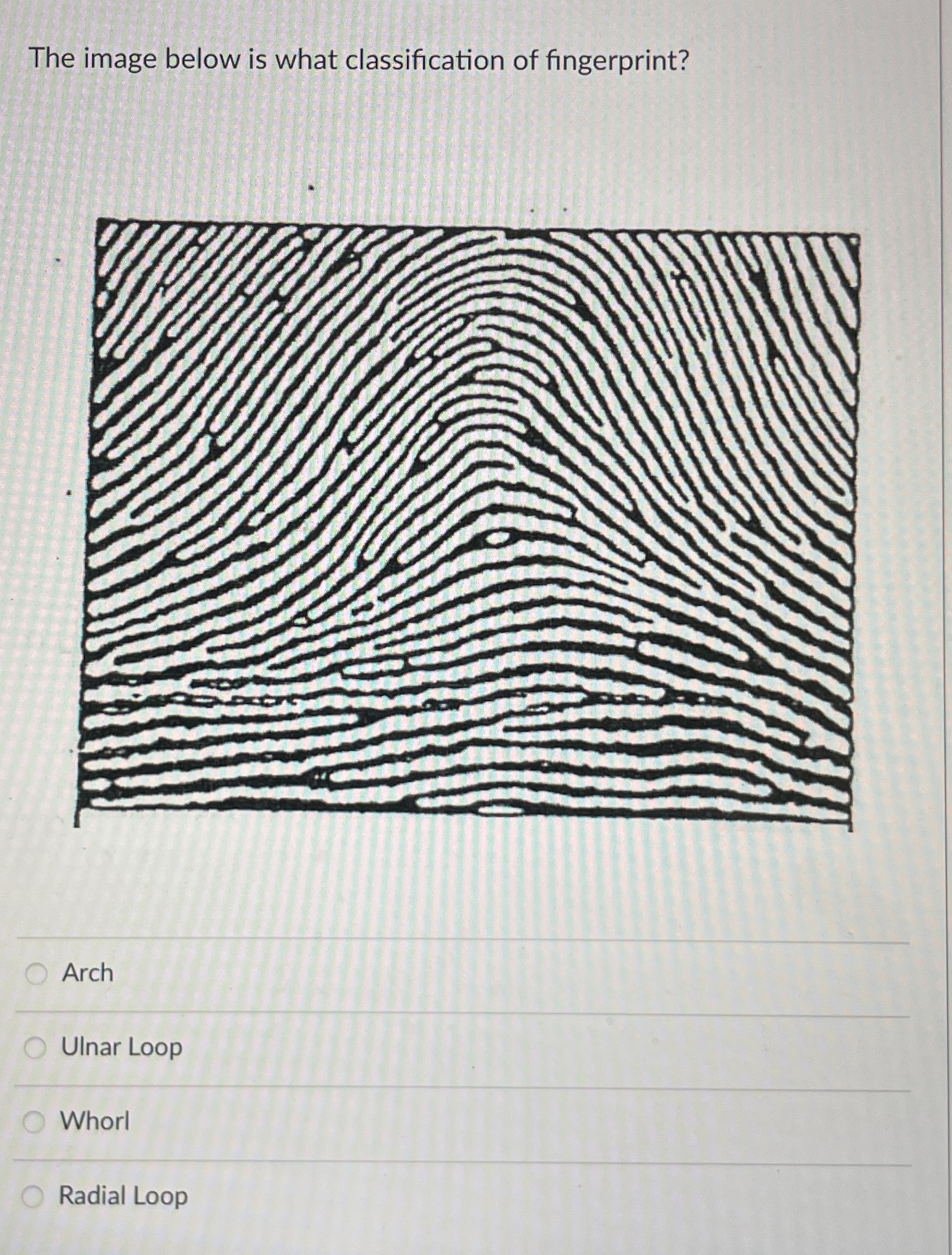 Are Your Fingerprints Unique?  The Ulnar And Radial Loop Difference - 0gnu6we