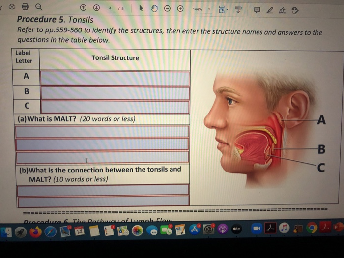 Solved 4 / 5 144 Procedure 5. Tonsils Refer to pp.559-560 to | Chegg.com