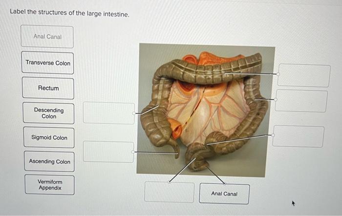 Solved Label The Structures Of The Large Intestine. | Chegg.com