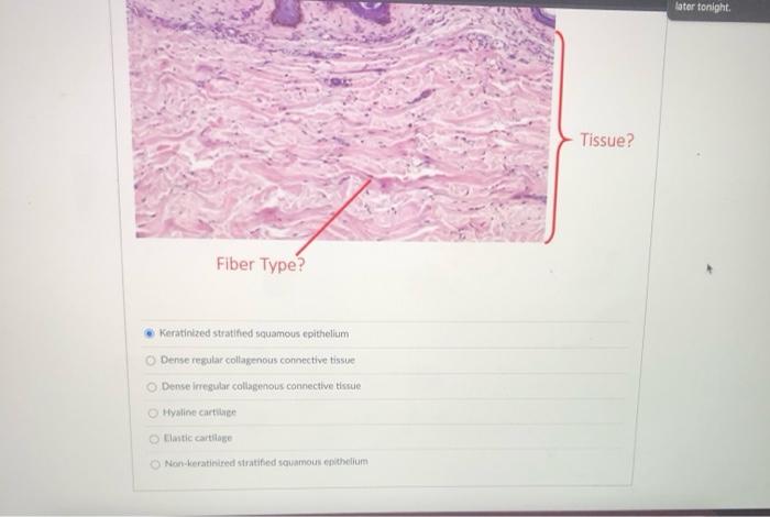 later tonight Tissue? Fiber Type? Keratinized stratified squamous epithelium Dense regular collagenous connective tissue Dens
