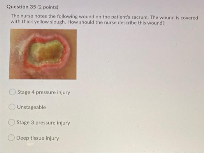 Solved Question 35 (2 points) The nurse notes the following