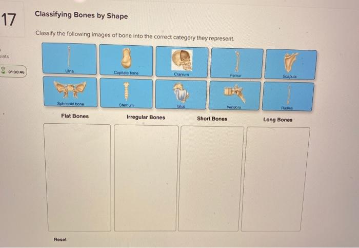 Solved 17 Classifying Bones by Shape Classify the following | Chegg.com