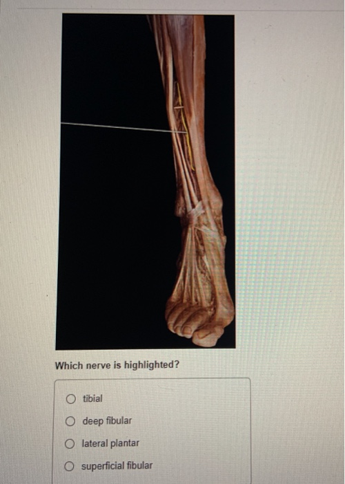 Solved Which nerve is highlighted? O tibial O deep fibular O | Chegg.com