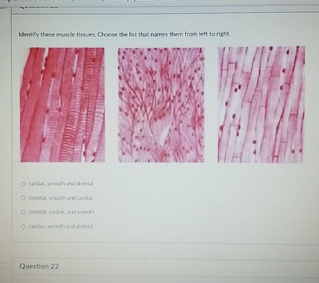 List Of Muscle Names / List Of Skeletal Muscles Of The Human Body Wikipedia : This is an almost complete list of the muscles of the human body.