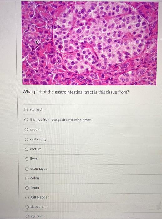 What part of the gastrointestinal tract is this tissue from? stomach It is not from the gastrointestinal tract O cecum o oral