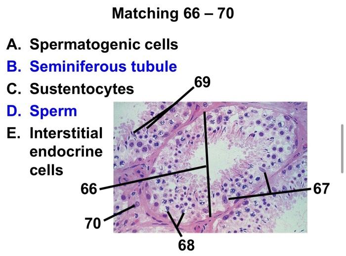 Solved Matching 66 – 70 69 A. Spermatogenic cells B. | Chegg.com