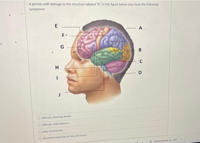 Solved Question 29 1 pts Damage to primary visual cortex can | Chegg.com