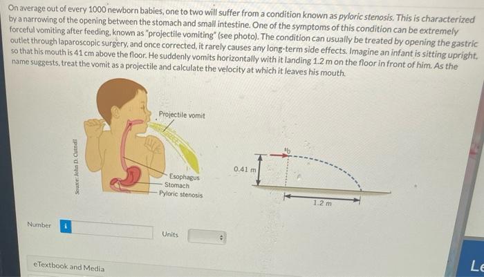 solved-on-average-out-of-every-1000-newborn-babies-one-to-chegg