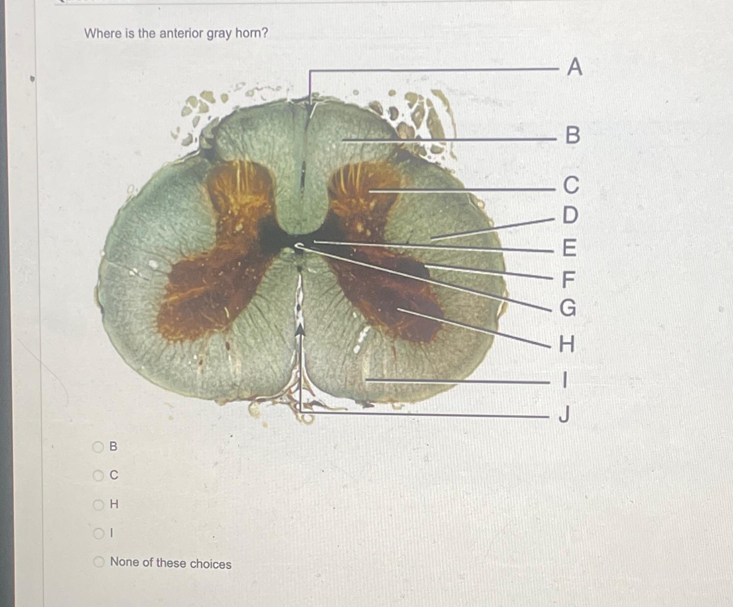 Solved Where Is The Anterior Gray Horn BCHINone Of These Chegg Com   Image