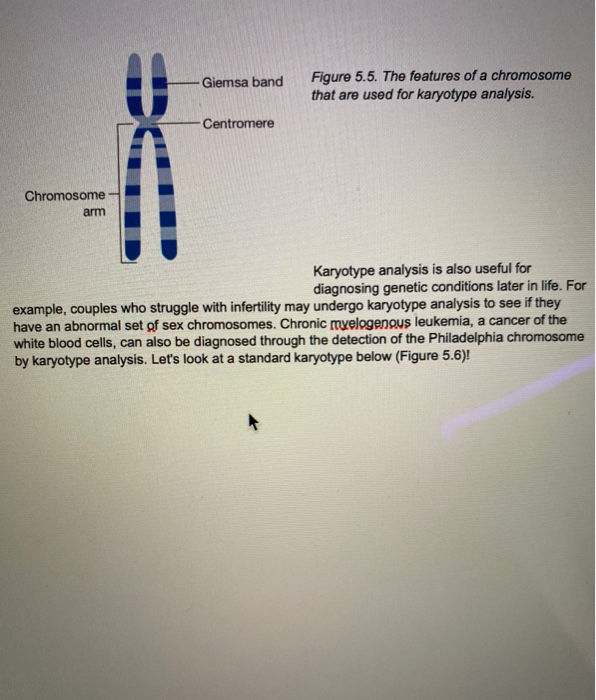 Solved Chromosomal Disorders can be Diagnosed with Karyotype