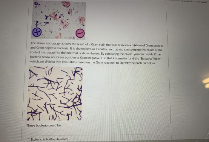 Solved The above micrograph shows the result of a Gram stain | Chegg.com