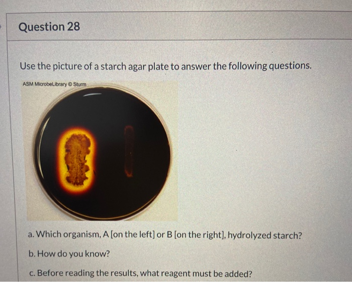 Question 28 Use the picture of a starch agar plate to