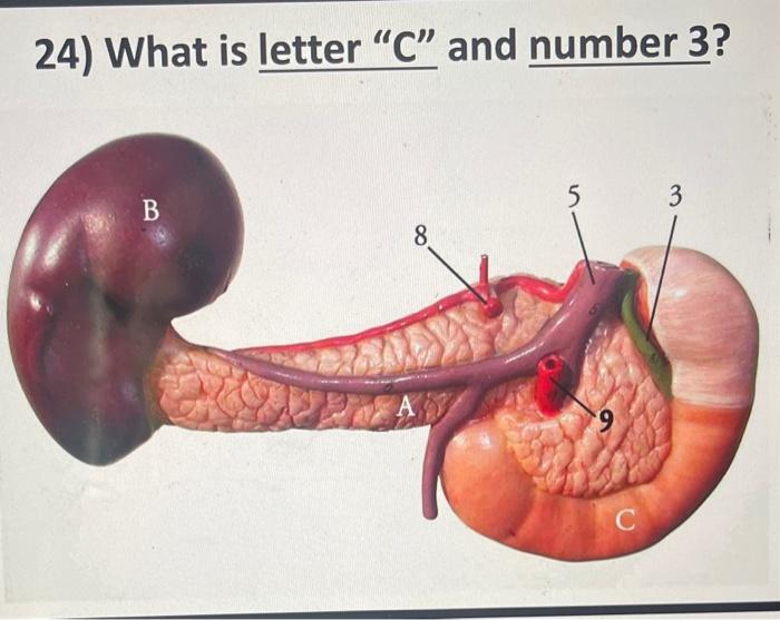 solved-21-what-anatomy-is-the-yellow-arrow-pointing-to-22-chegg