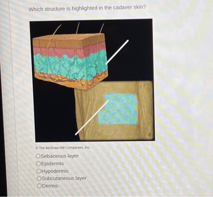 solved-which-structure-is-highlighted-in-the-cadaver-skin-chegg