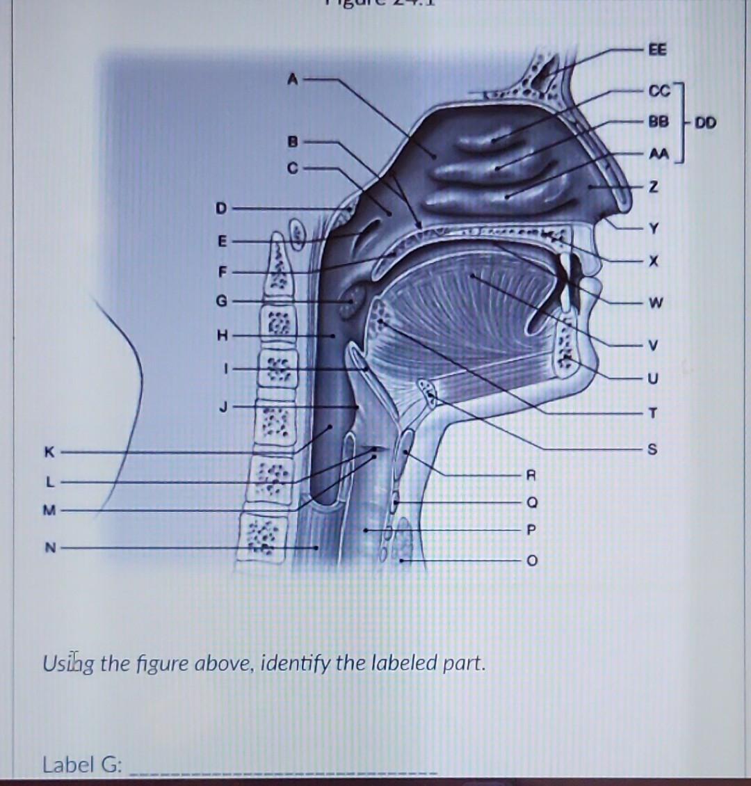 Solved Usithg the figure above, identify the labeled part. | Chegg.com