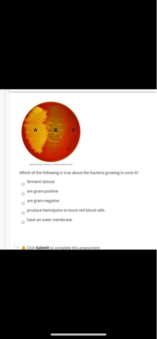 Solved Which of the following is true about the bacteria | Chegg.com