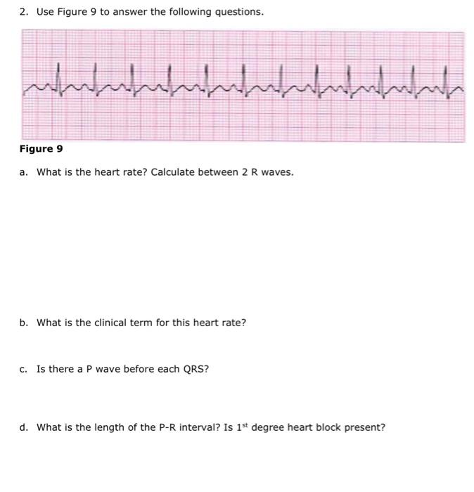 Solved Fiqure 6 is a guide to ECG interpretation. Use Fiqure | Chegg.com